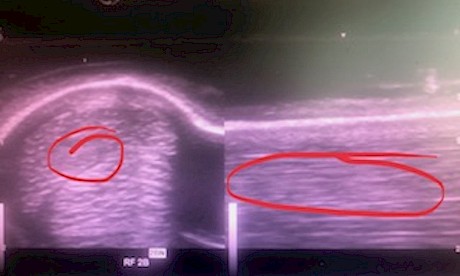 Last September’s scan showed a disruption to the tendon fibres in Cru Bourgeois’ off foreleg.