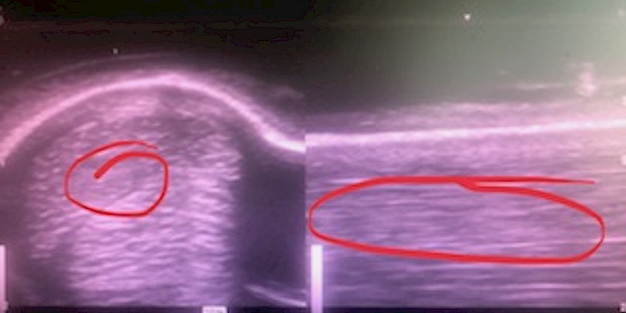 Last September’s scan showed a disruption to the tendon fibres in Cru Bourgeois’ off foreleg.